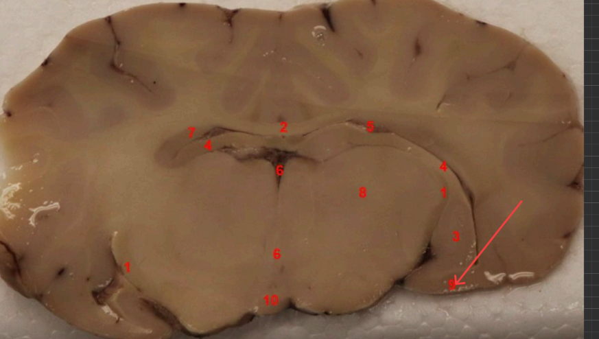 <p>what cortex is this, function</p>