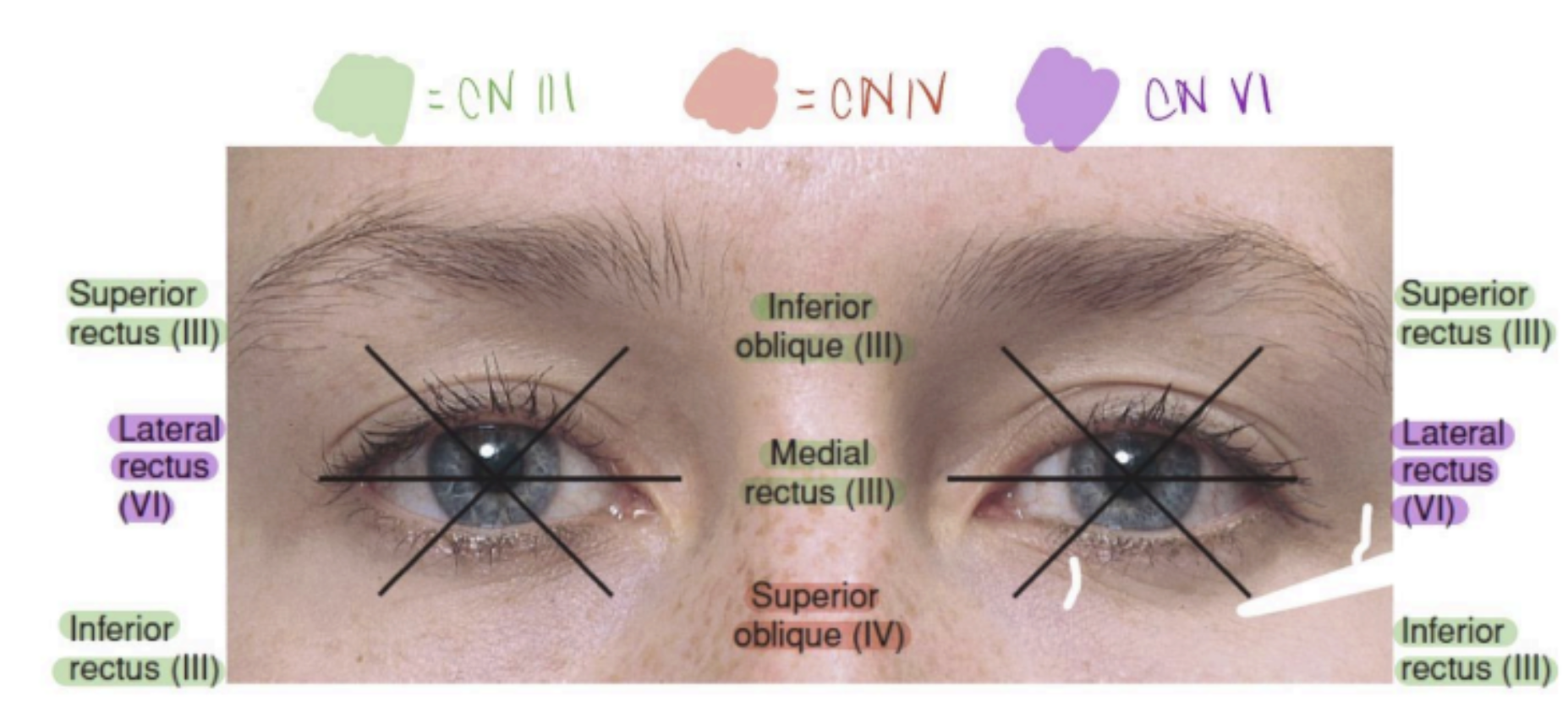 <p>All CN III except for Lateral Rectus (CN VI) and Superior Oblique (CN IV)</p><p></p>