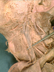 <p>Identify the structure</p>