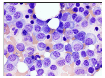 <p>Cause of Clinical Manifestations</p>