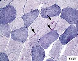 <p>NADH diaphorase results:</p><p>dark purple deposits:</p><p>dark purple:</p><p>light purple:</p>