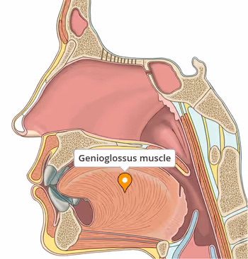 <p>Genioglossus (origin)</p>