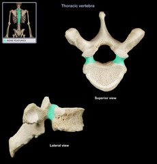 <p>Name this specific part of the thoracic vertebra.</p>