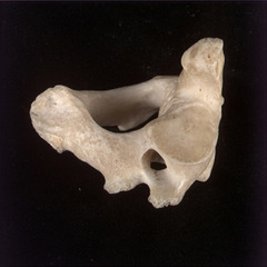 <p>Name of Bone and vertebrae</p>
