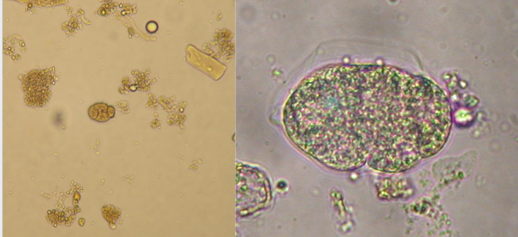 <p>What is the kingdom, phylum, order, and family of this parasite</p>