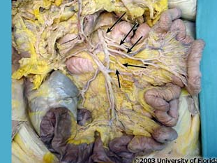 <p>what arteries are pictured?</p>