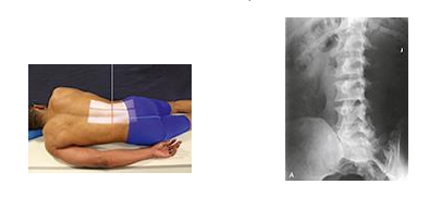 <p>what special view of the L-spine is this?</p>