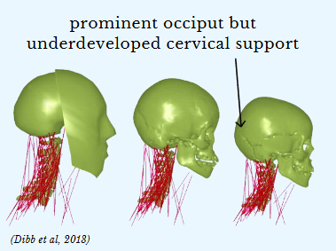 <p>Children have a <strong>prominent occiput</strong> but <strong>underdeveloped cervical support. </strong>Their big heads can cause injury with little injury or obvious signs!</p><p></p><p>Infants have <strong>fontanelles</strong>, a “soft spot” caused by any of the soft membranous gaps between the incompletely formed cranial bones of an infant.</p>