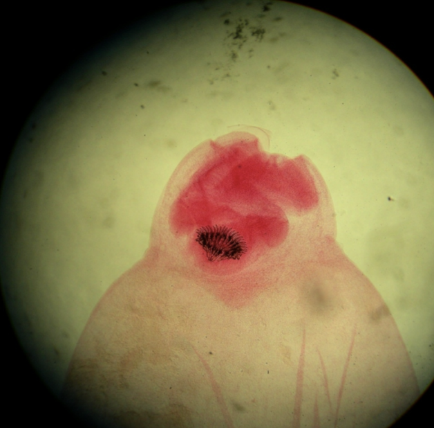 <p>What cestode/tapeworm/parasitic worm is this?</p>