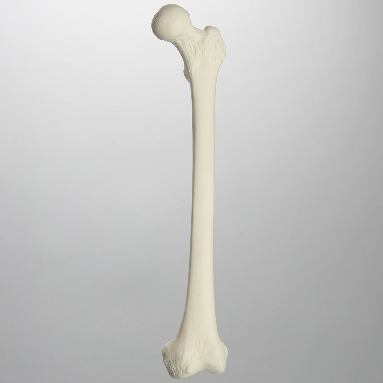 <p>What bone is this?</p>