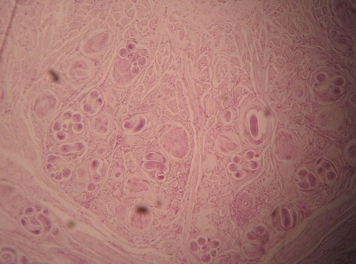 <p><span>Trichinella spiralis — transmission & ID?</span></p>