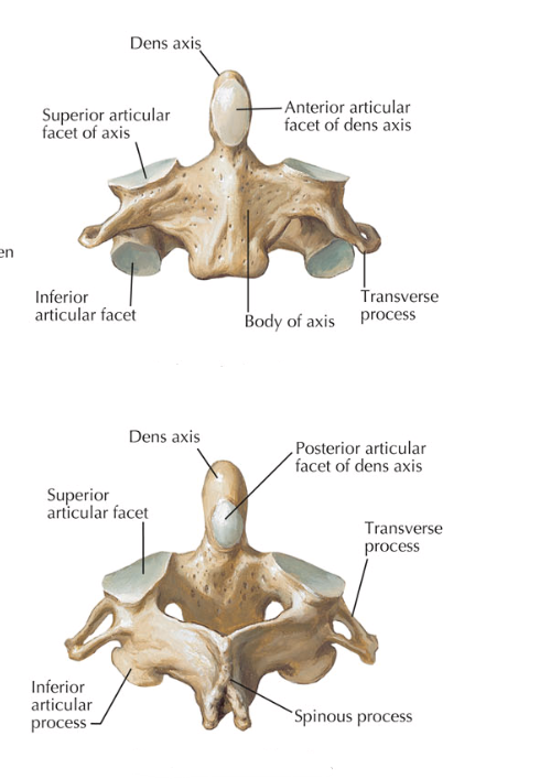 <p>C2. Wonky, supports atlas to allow for rotation (through the atlanto-axial synovial joint). Contains the Dens/Odontoid process (fits through the anterior arch of the atlas). </p>