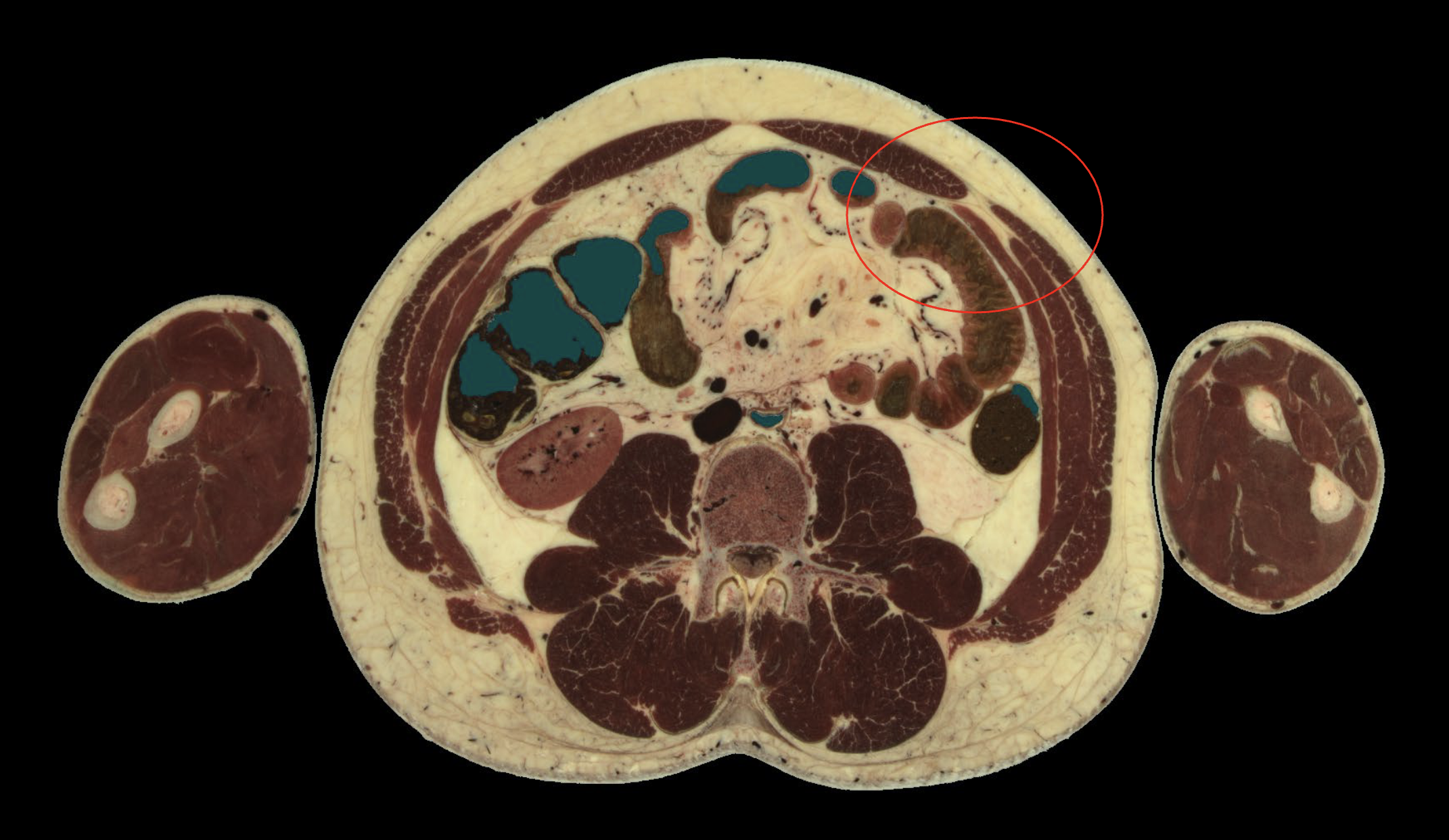 <p>Where, on the abdomen, would you find this cross section?</p>