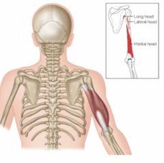 <p>What muscle is highlighted?</p>
