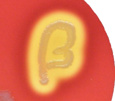 <p>A(n) __________ hemolysis test shows the <strong>complete</strong> breakdown of red blood cells. </p>