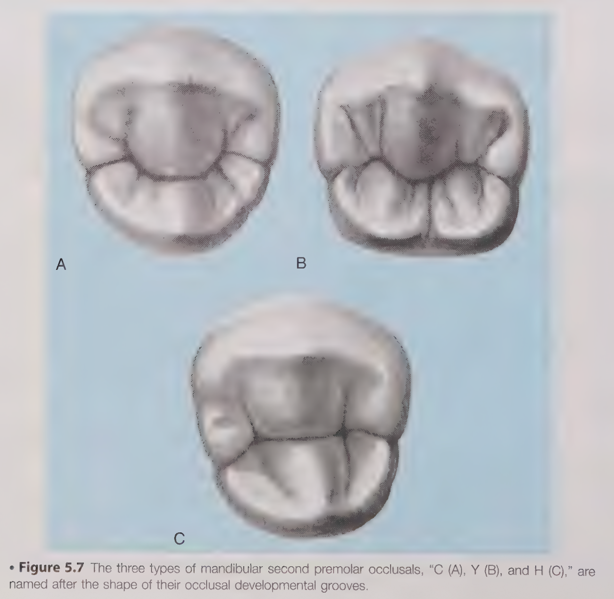 <p>C shaped, Y shaped, H shaped </p>