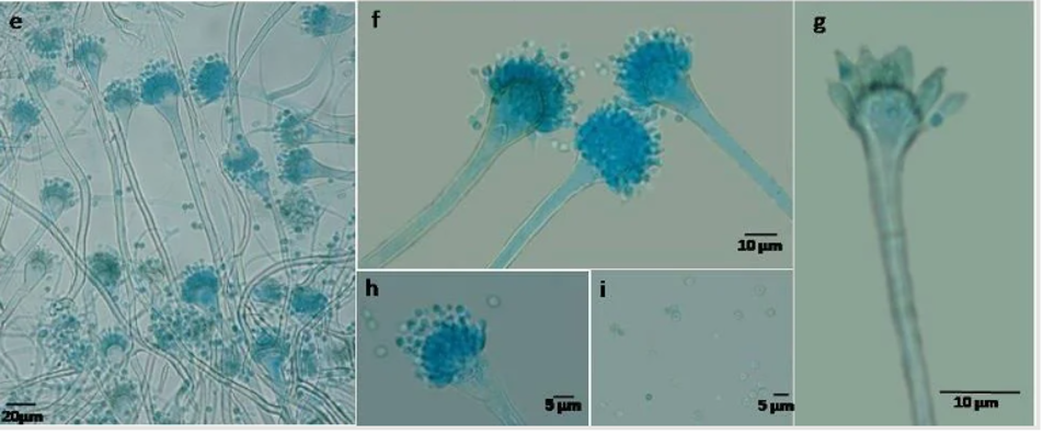 <p>Identify this fungus</p>