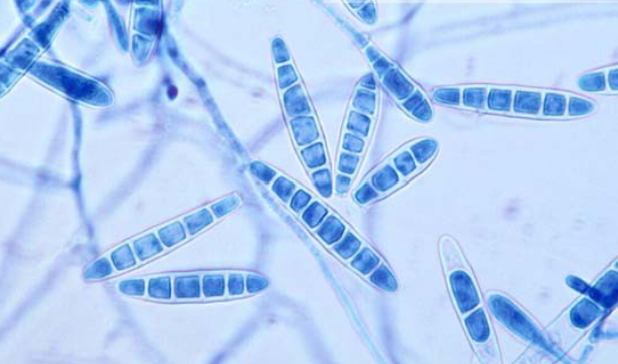 <p>Identify the Fungi</p>