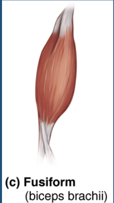 <p>fusiform parallel fascicles </p>