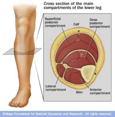 <p>Pallor: pale, shiny skin</p><p>Paralysis: inability to move</p><p>Pulselessness: late finding</p><p>Pain: out of proportion to exam</p><p>Paresthesias: pins and needles</p><p>Poikilothermia: different limb temperatures</p><p>all distal to the area of injury</p>