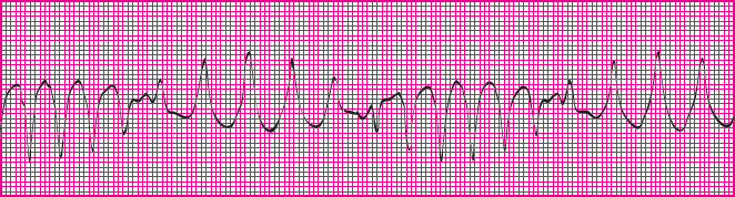 <p>Which rhythm is this?</p>