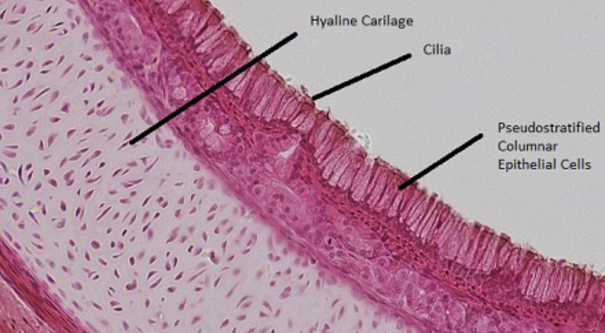 <p>Tracheal cartilage </p>