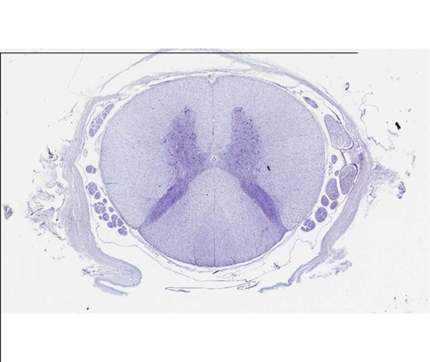 <p>mediates reflexes</p><p>butterfly shape with posterior/anterior horns</p><p>(ugh, the slide in the photo is beautiful<3)</p>