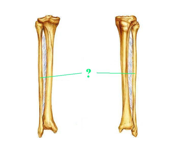 <p>Identify the indicated bone</p>