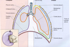 <p>fluid in the pleural space</p><p>excess fluid --> limits ling expansion --> lung collapse and difficult breathing</p>