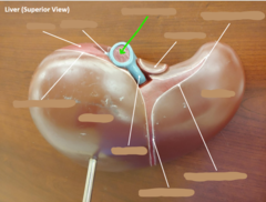<p>What structure is the green arrow pointing to?</p>