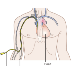 <p>which line is this, where does tip placement begin and end?</p>