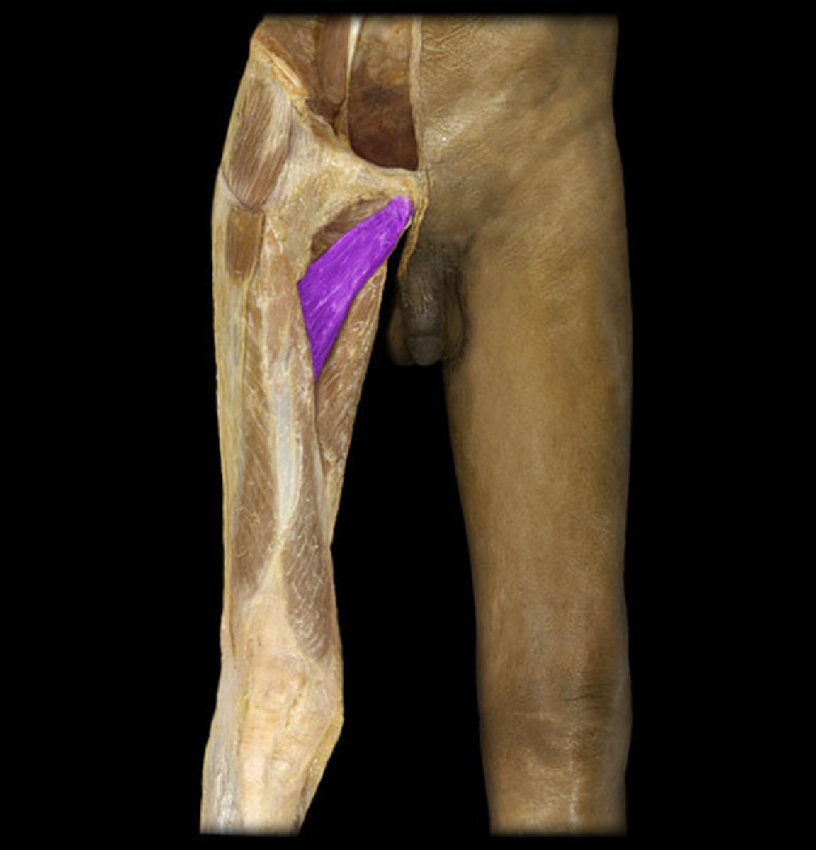 <p>Adduct/Flex hip</p><p>O: pelvis</p><p>I: femur</p>