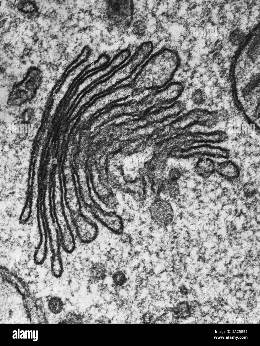 <p>Stack of flattened cisternae which, unlike the rough endoplasmic reticulum, are unconnected. Transport vesicles form at each cisternae to transport proteins made by the rough endoplasmic reticulum into the cystol or out of the cell via a process called exocytosis. </p>