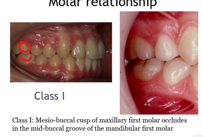 <p>Mainly based on the 6, if not present then use other teeth </p>