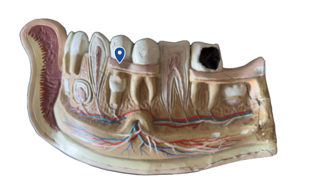 <p>Name this tooth type.</p>