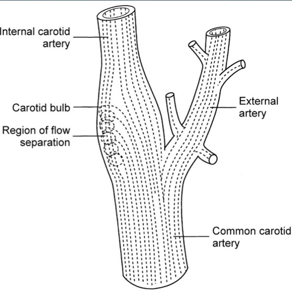 <p>Part of extracranial cerebrovascular system; no extracranial branches; intracranially (feeds brain), give rise to ophthalmic artery; is divided into 4 major segments:</p><ul><li><p>cervical</p></li><li><p>Petrous</p></li><li><p>cavernous</p></li><li><p>Cerebral</p></li></ul><p>diamter should be 0.4-0.5cm</p>