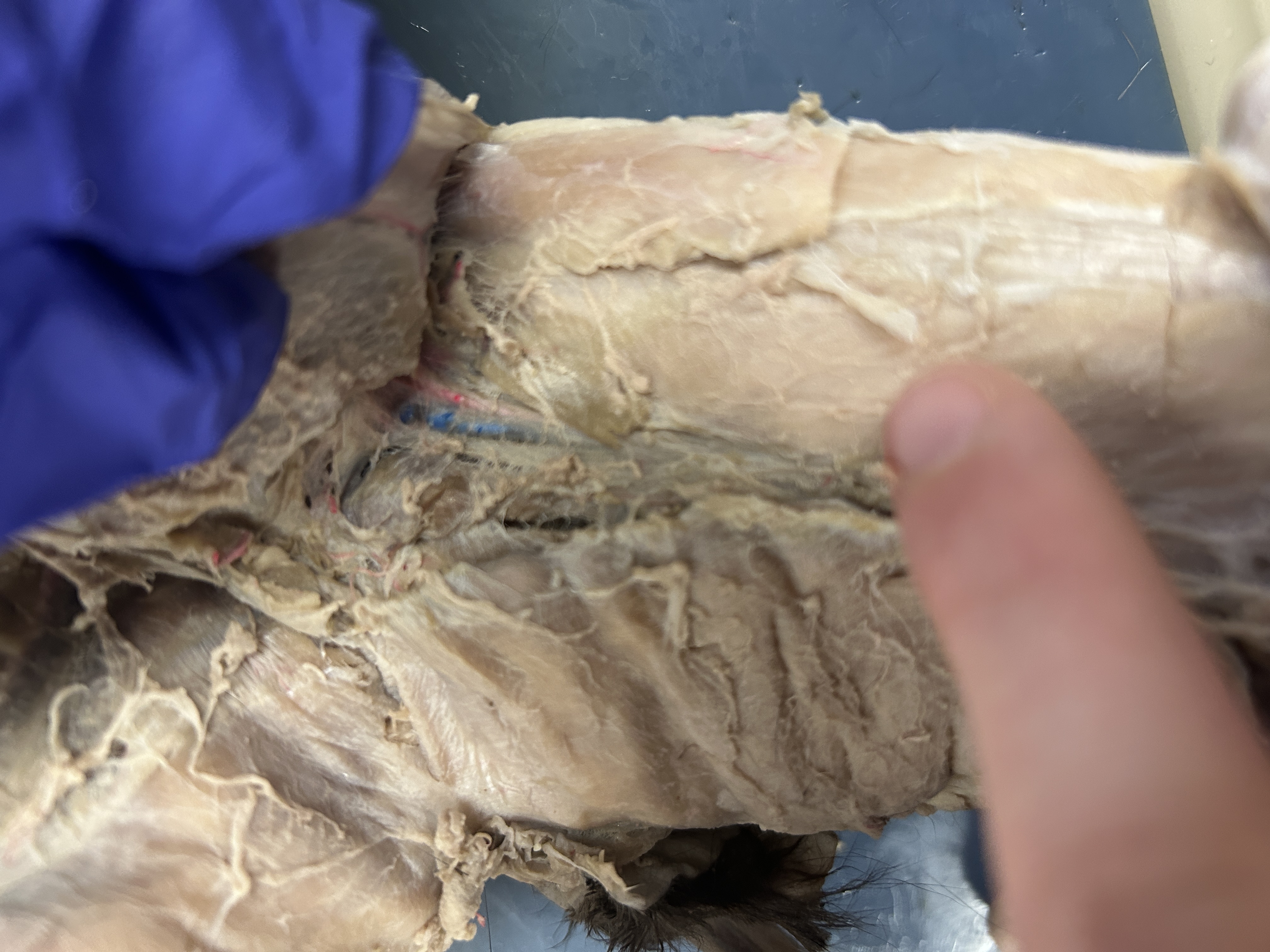 <p>Vastus Medialis (Close to inside theigh) </p>