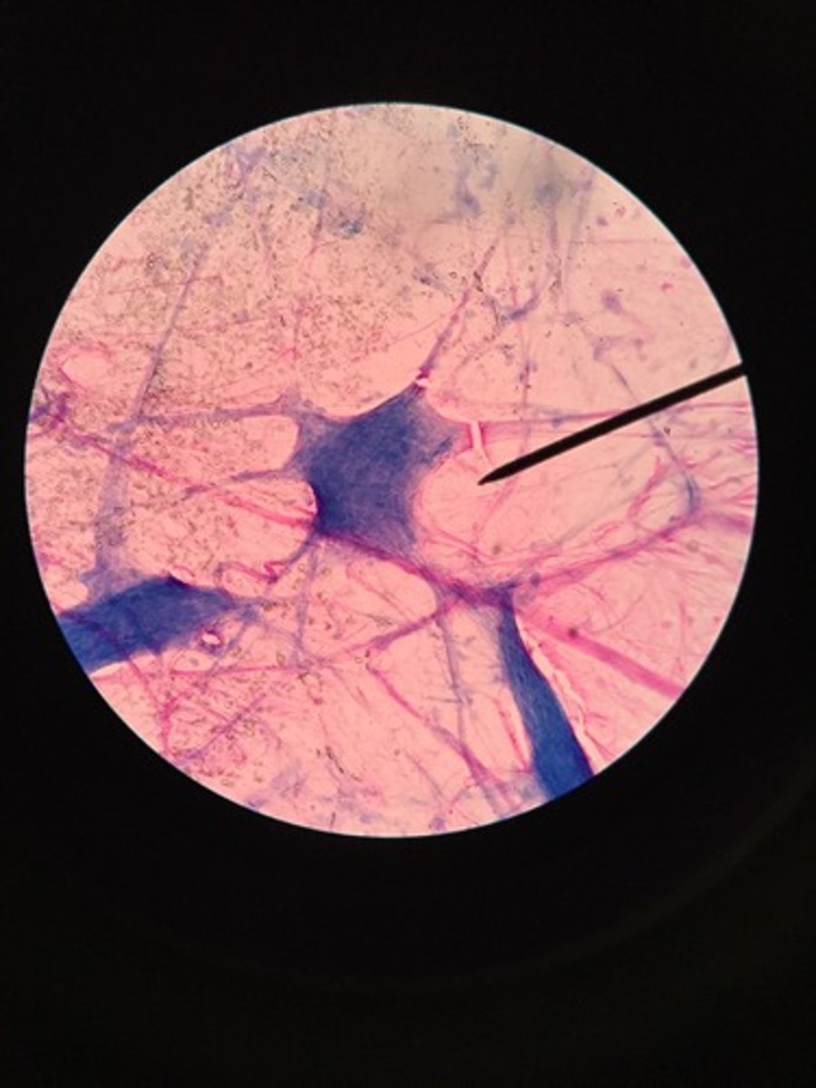 <p>Branching extensions (dendrites, axon)</p>