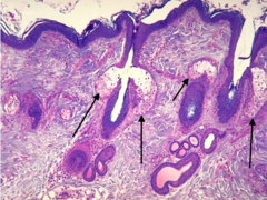 <p>what glands are pointed to by the black arrows (anatomical name)</p>