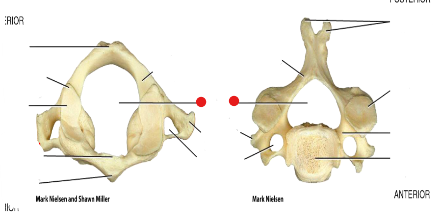 <p>Identify the structure pinned</p>