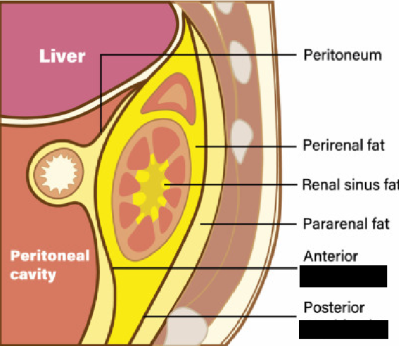 <p><span style="background-color: transparent;">The kidneys are partially held in place by connective tissue connections called _____ _____ that connect to the outer portion of the __________.</span></p><p></p>