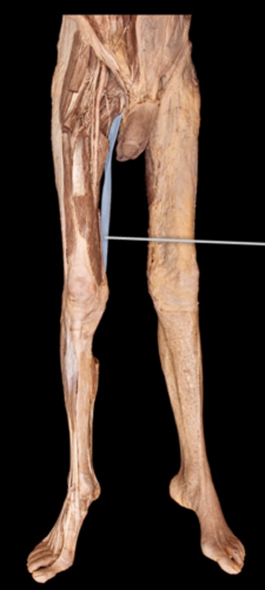 <p>What muscle is this?</p>
