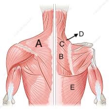 <p>A</p>