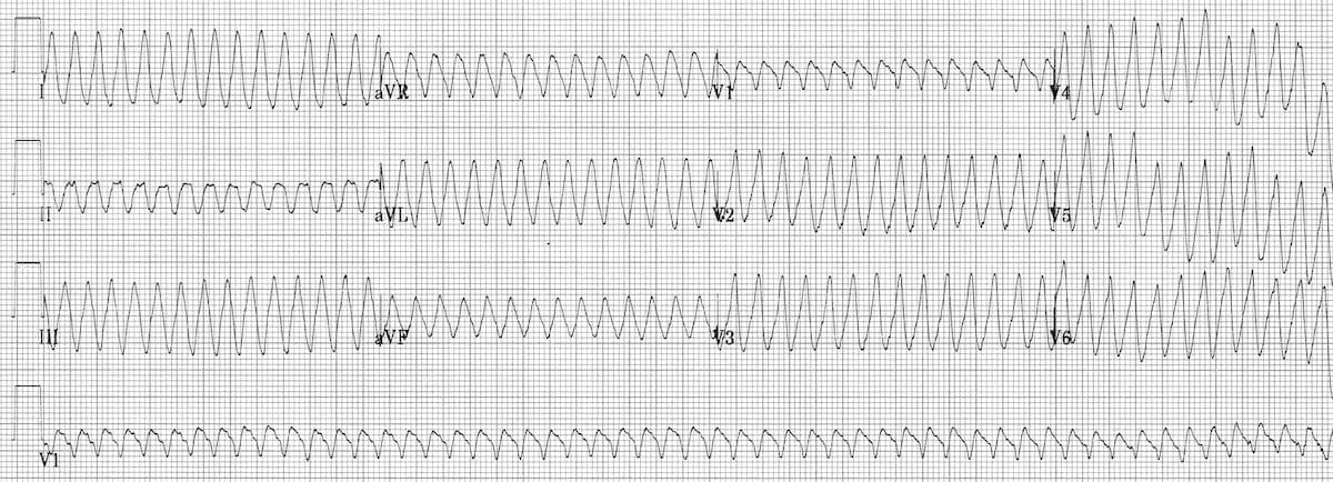 <p>What rhythm is this?</p>