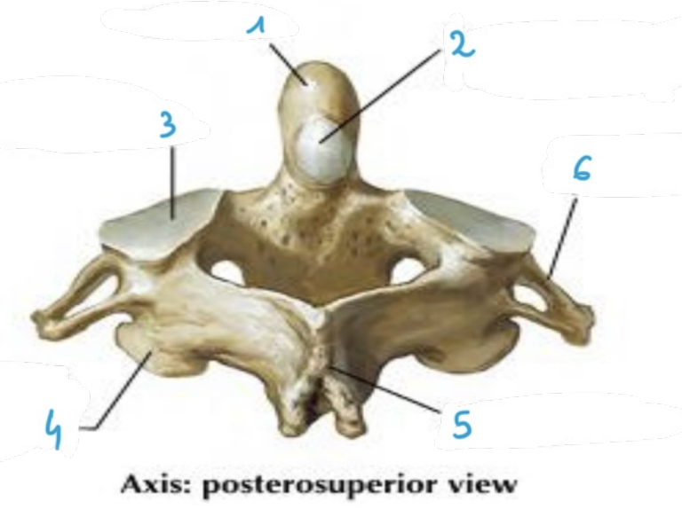 <p>identify structure #6 of the <strong>axis</strong> vertebrae (posterosuperior)</p>