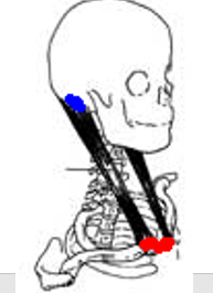 <p>What muscle is being depicted? And what is its action?</p>