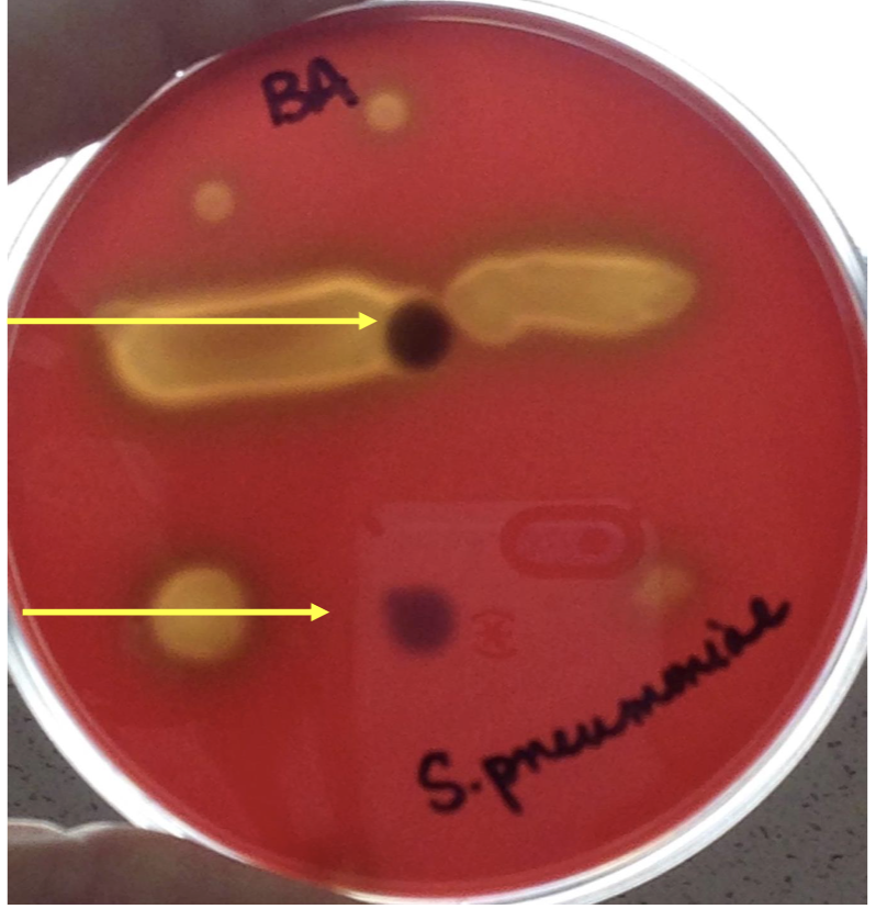 <p>what bacteria is this?</p>