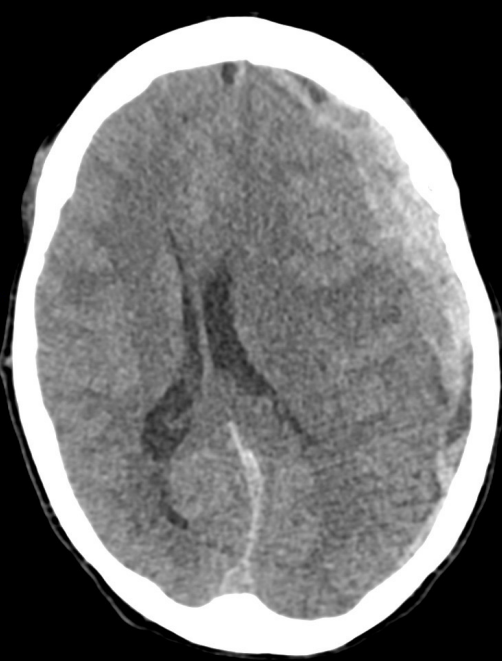 <p>Name the pathology </p>