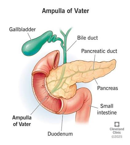 <p>transient obstruction of ampulla of vater</p>