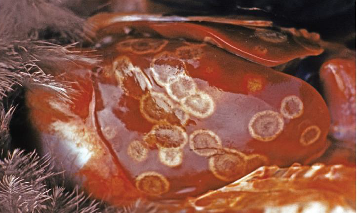 <p>Name the protist that causes this condition</p>